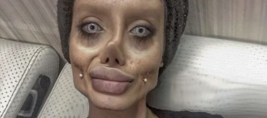 KATSO KUVAT! Iranilainen tyttö Sahar Tabar kävi 50 operaatiossa näyttääkseen Angelina Jolielta